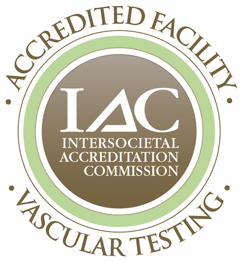 Vascular Testing