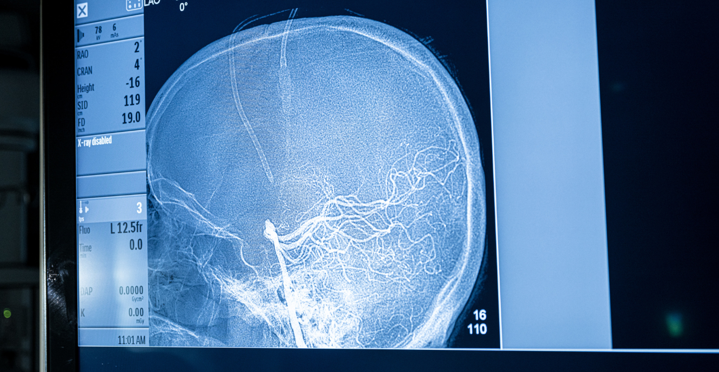 Brain X-Ray