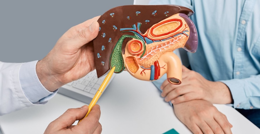 Photo of a doctor showing a patient a model gallbladder