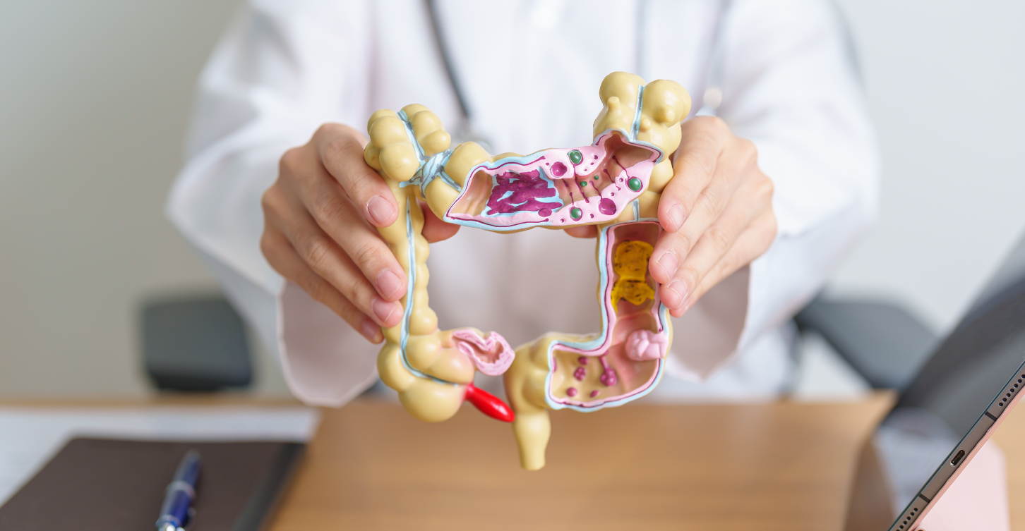 3D model of a colon