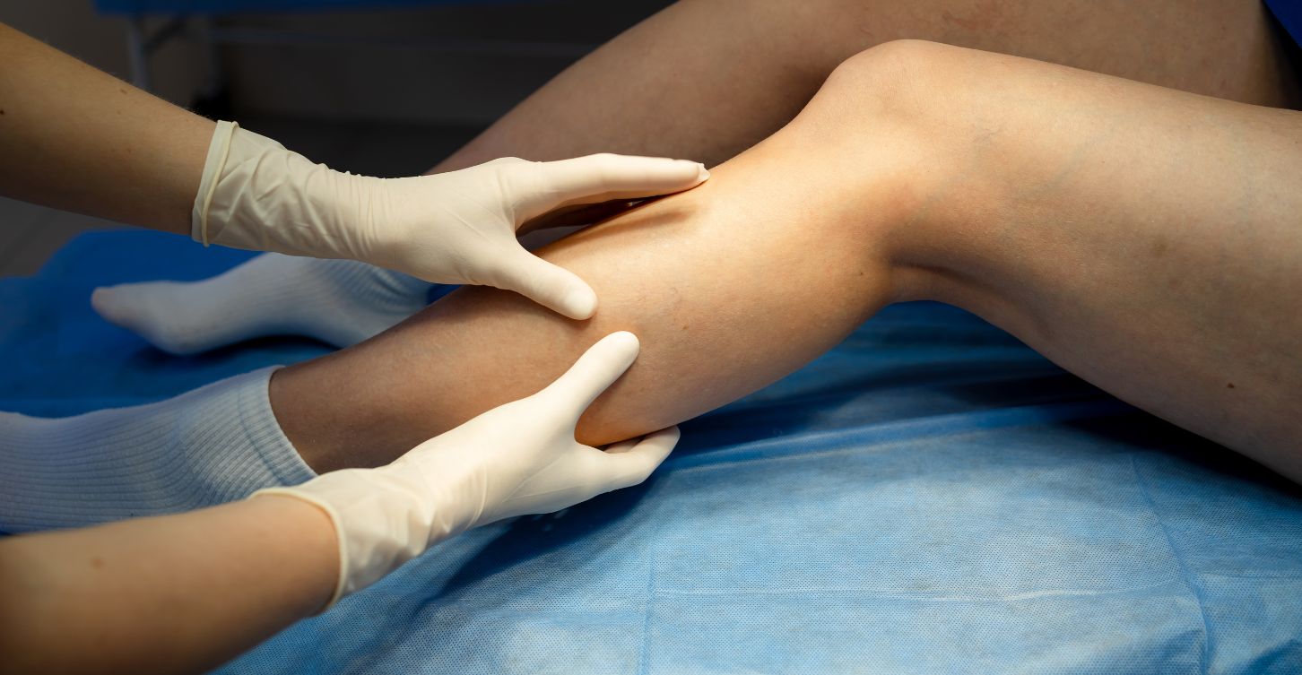 Doctor looking at leg for Critical Limb Ischemia