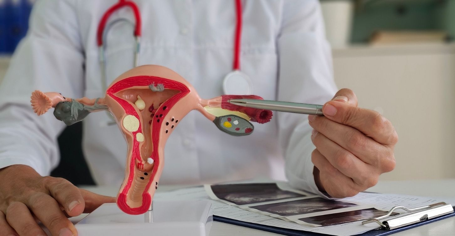 Doctor pointing at a model of a uterus