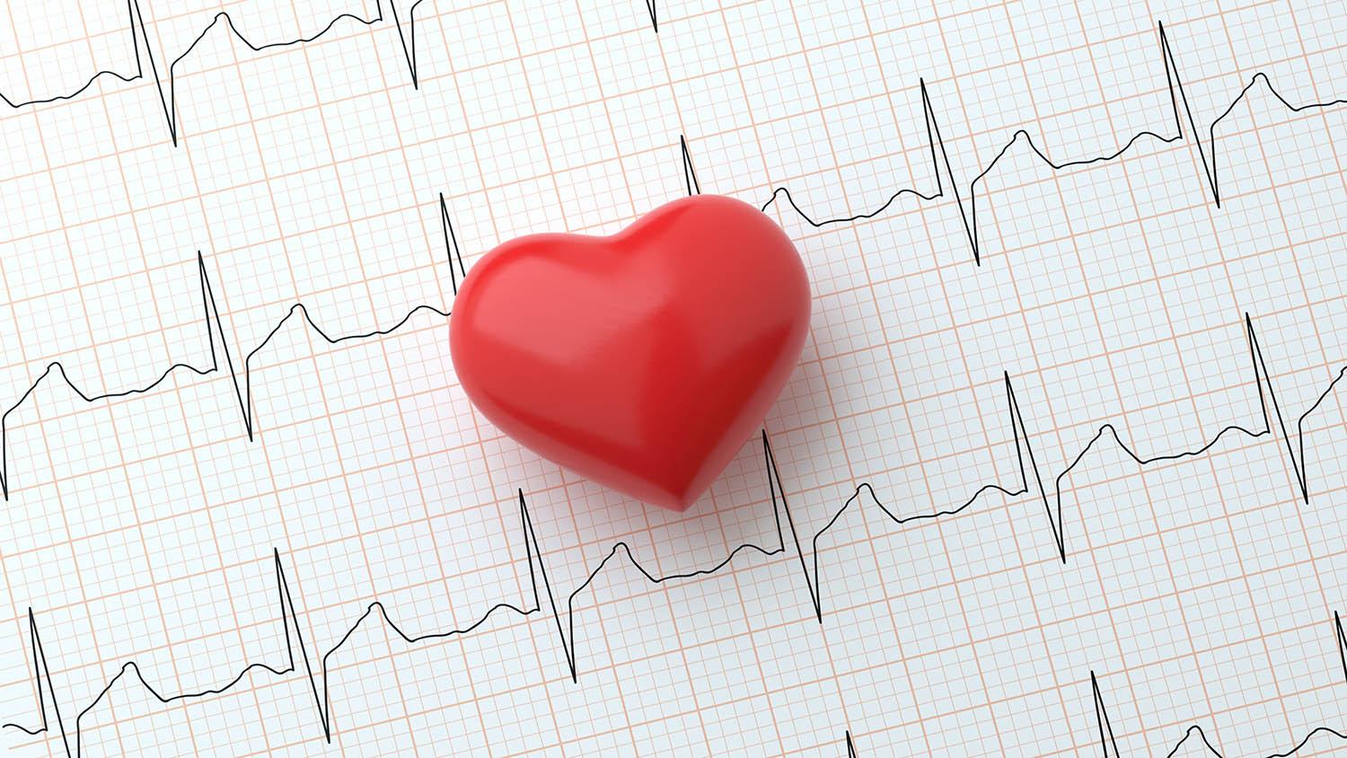 Atrial Fibrillation: An Overlooked Heart Disorder