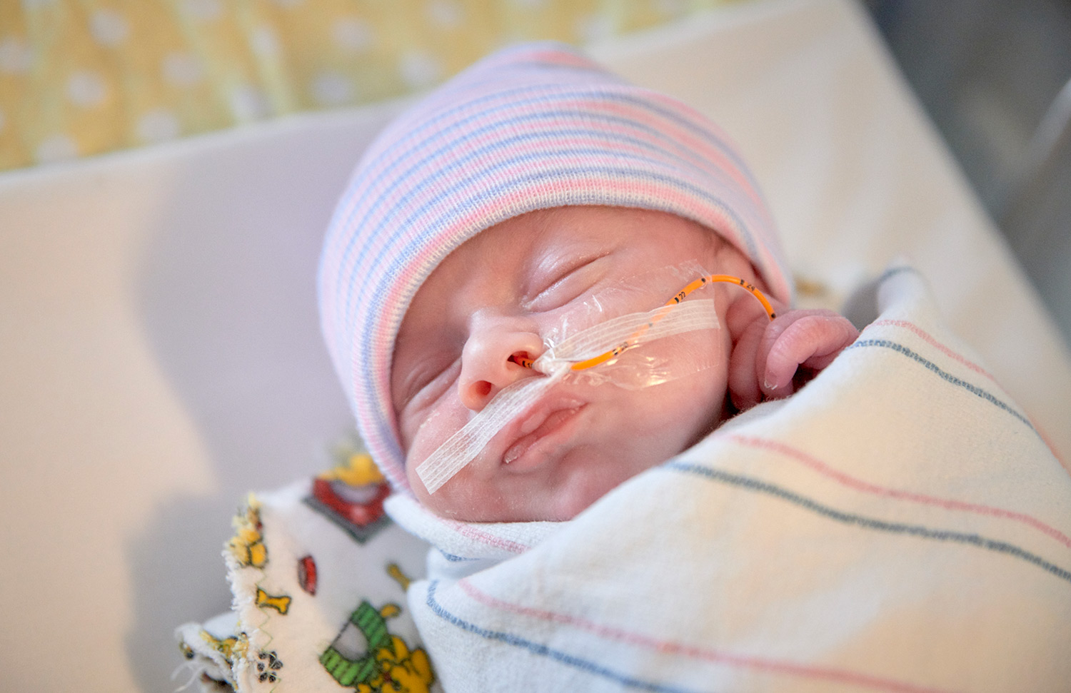 A newborn child in NICU