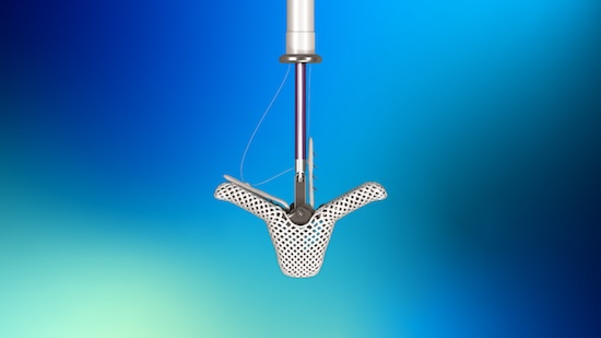 Mitral Valve